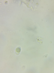 Pseudolaccaria pachyphylla