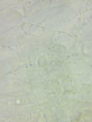 Pseudolaccaria pachyphylla