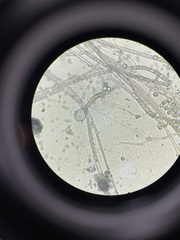 Rhizopus