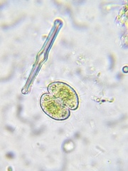 Cosmarium phaseolus