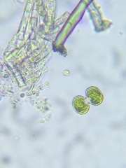 Cosmarium contractum