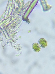 Cosmarium contractum