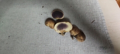 Scleroderma