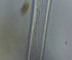 Spirostomum