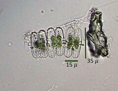 Sphaerozosma vertebratum