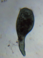 Stentor coeruleus