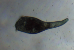Stentor coeruleus