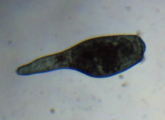 Stentor coeruleus
