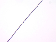Dolichospermum