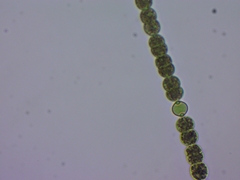 Dolichospermum