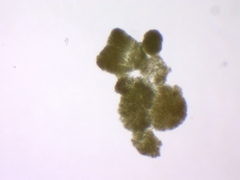 Microcystis