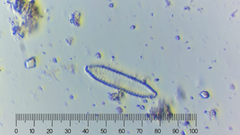 Surirella angusta
