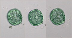 Coelosphaerium aerugineum