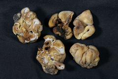 Hydnotrya