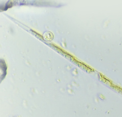 Chytridiomycota