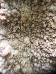 Phlebia centrifuga