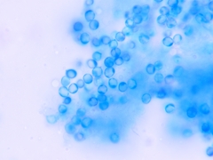 Tricholoma subsejunctum