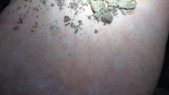 Ponerinae