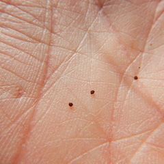 Cerastium beeringianum