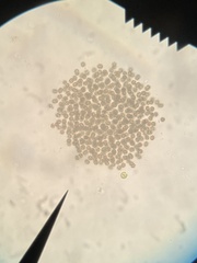 Microcystis