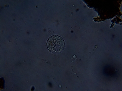 Amoebidae