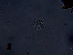 Amoebidae