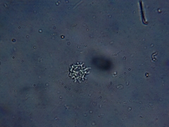 Amoebidae
