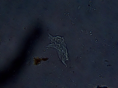 Amoebidae