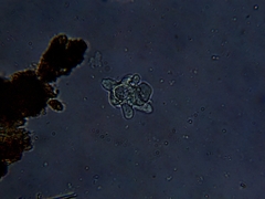 Amoebidae
