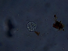 Amoebidae