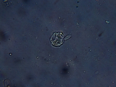Amoebidae