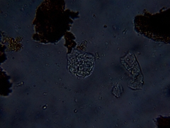 Amoebidae