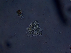 Amoebidae