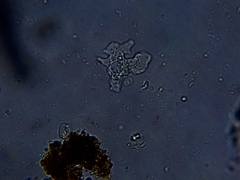 Amoebidae