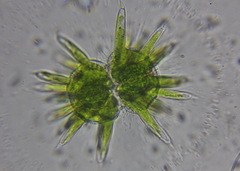 Staurastrum wolleanum