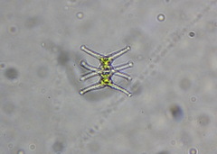 Desmidiaceae