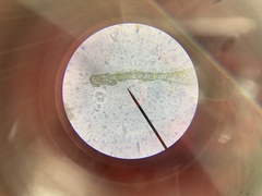 Fissidens ventricosus