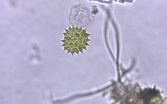 Pseudopediastrum boryanum