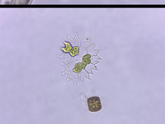 Pseudopediastrum boryanum
