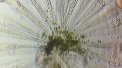 Conochilus hippocrepis