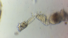 Conochilus hippocrepis