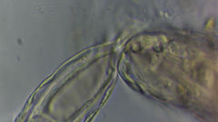 Conochilus hippocrepis