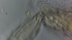 Conochilus hippocrepis