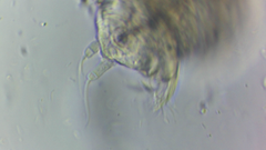 Conochilus hippocrepis