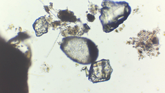 Amoebozoa