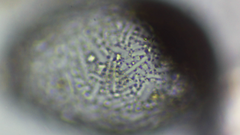 Amoebozoa