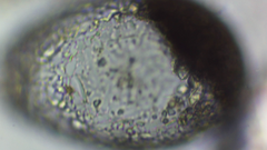 Amoebozoa