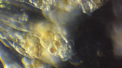 Conochilus hippocrepis