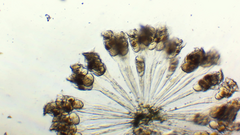 Conochilus hippocrepis