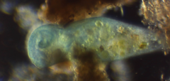 Stentor coeruleus